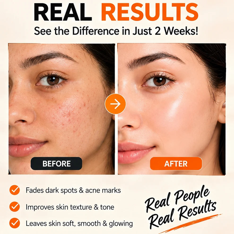 GMEELAN Orange Enzyme Brightening Gel