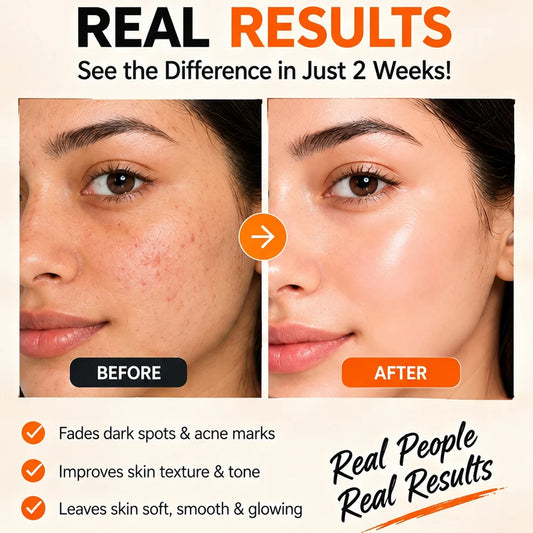 GMEELAN Orange Enzyme Brightening Gel